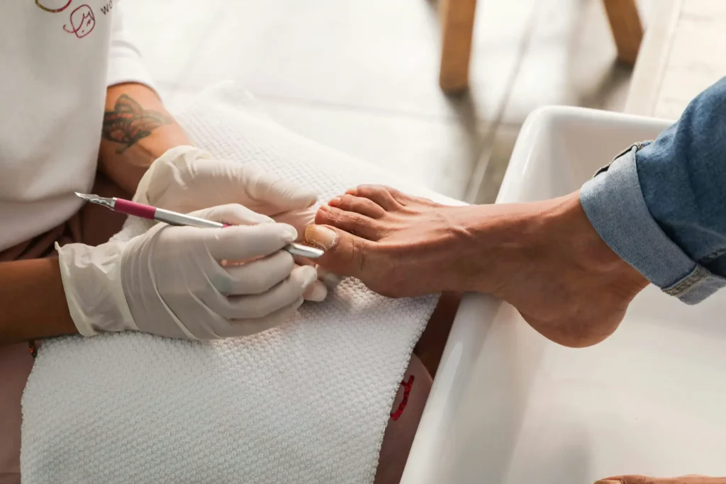 Pėdų ir nagų problemos – kada reikalinga profesionali podologo pagalba?